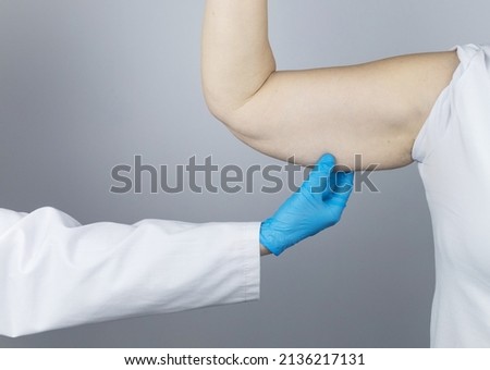Brachioplasty. Plastic arms, dangling skin at the elbow. An older woman shows the surgeon problem areas of the forearm. Examination before cosmetic surgery Royalty-Free Stock Photo #2136217131