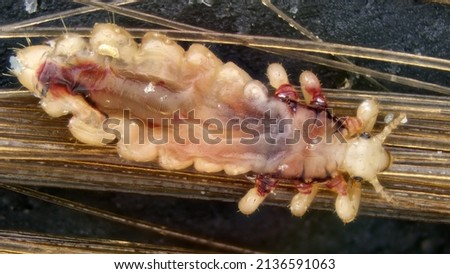 Head louse (Pediculus humanus capitis) under the microscope.