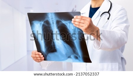 Lung Cancer or Pneumonia. Doctor check up x-ray image have problem lung tumor of patient or long covid 19 Royalty-Free Stock Photo #2137052337