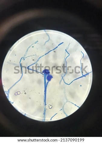 aspergillus mushroom. sp under the microscope