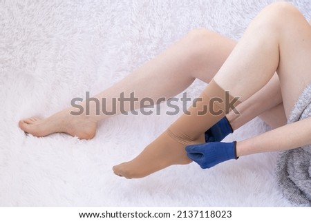 The girl puts on compression stockings. Special gloves for wearing compression stockings. The process of putting on medical stockings. Graduated compression stockings. Prevention and treatment of