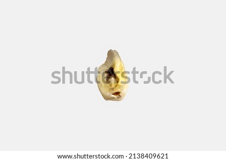 Milk tooth caries. Milk tooth on a white background.