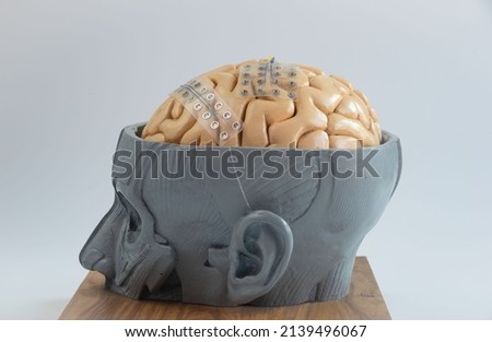 Two of subdural grid electrode for brain waves recording or electroencephalography on the artificial brain model cortex Royalty-Free Stock Photo #2139496067