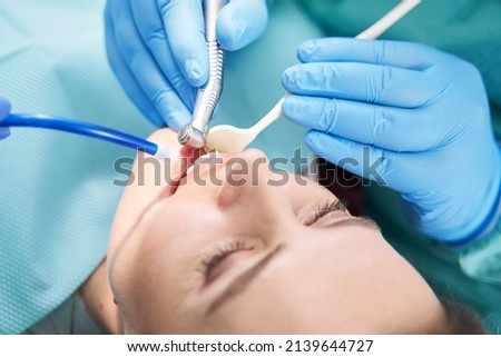 Dentist hands performing dental procedure with dental drill Royalty-Free Stock Photo #2139644727