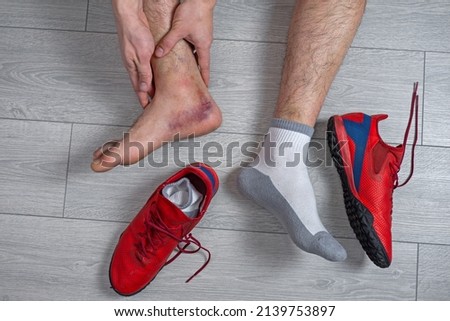 Ankle injury with dislocation and sprains. Fracture or Leg sprain injury of young sports man.  Royalty-Free Stock Photo #2139753897