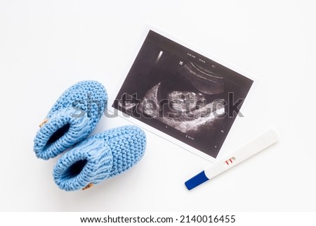 Pregnancy background. Baby accessories with ultrasound picture of unborn baby