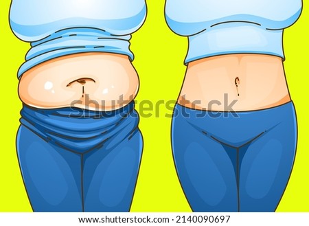 A woman's body with belly fat. Before, after. Healthcare illustration. Vector illustration.  Royalty-Free Stock Photo #2140090697