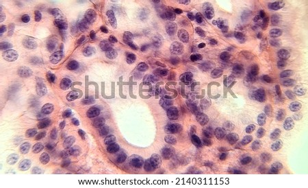 Cells of glandular epithelium, microscopic photo of permanent preparation