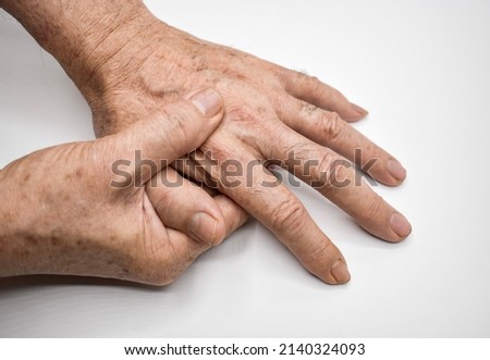 Hands of Southeast Asian elder man. Concept of hand pain, arthritis and finger problems.