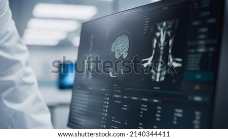 Medical Hospital: Neurologist and Neurosurgeon Talk, Use Computer, Analyse Patient MRI Scan, Diagnose Brain. Brain Surgery Health Clinic Lab: Two Professional Physicians Look at CT Scan. Close-up Royalty-Free Stock Photo #2140344411