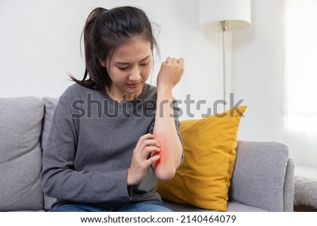 Asian Woman Scratching her Arm Suffer from Allergy Itchy Skin Royalty-Free Stock Photo #2140464079