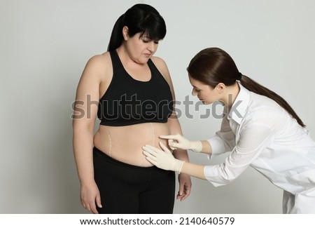 Doctor consulting obese woman on light background. Weight loss surgery Royalty-Free Stock Photo #2140640579