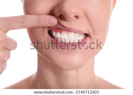 Woman showing inflamed gums on white background, closeup view Royalty-Free Stock Photo #2140712601