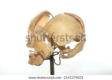bone. skull. anatomy. medical. head parts. jaws. skull bone. 