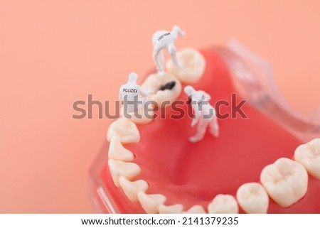 Dental caries found by micro examiner Royalty-Free Stock Photo #2141379235