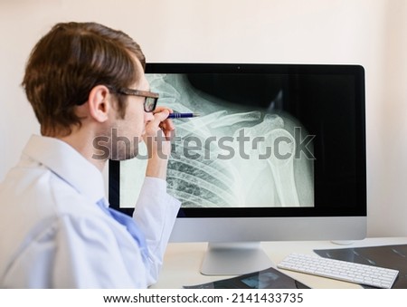 Man radiologist analyzing a patient x ray with a clavicle fracture. Royalty-Free Stock Photo #2141433735
