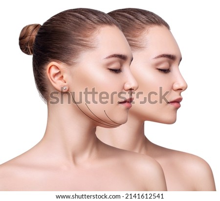 Beautiful woman before and after fat chin correction. Royalty-Free Stock Photo #2141612541