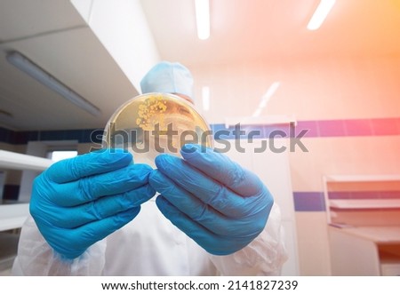 colonies of bacteria. A laboratory assistant holds a petri dish containing gram-positive lactobacilli grown on agar as part of a scientific project.