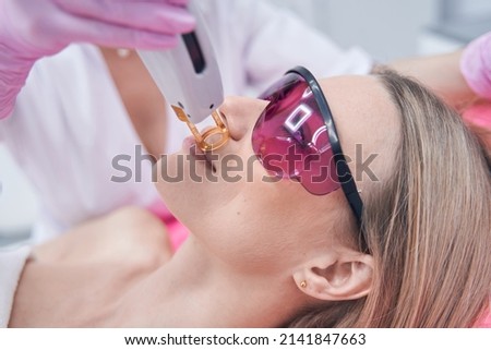 Patient wearing safety goggles during facial depilation procedure Royalty-Free Stock Photo #2141847663