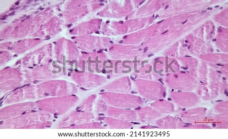 Skeletal striated muscle fibers in cross section showing the presence of several nuclei multinucleated cells located in the cell periphery. Light microscope photomicrograph. Royalty-Free Stock Photo #2141923495