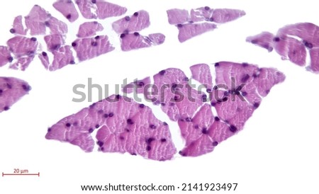 Skeletal striated muscle fibers in cross section showing the presence of several nuclei multinucleated cells located in the cell periphery. Light microscope photomicrograph. Royalty-Free Stock Photo #2141923497