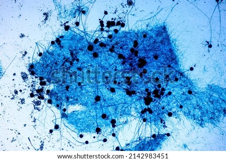 Aspergillus niger and Aspergillus oryze  (mold) under microscope for Microbiology in Lab.
 Royalty-Free Stock Photo #2142983451