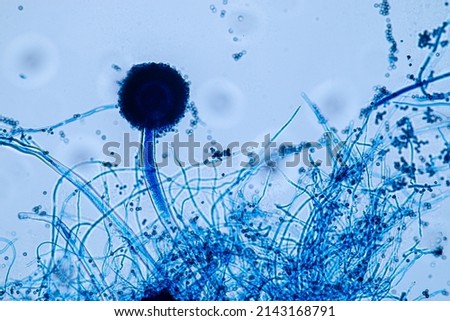 Aspergillus niger and Aspergillus oryze  (mold) under microscope for Microbiology in Lab.
 Royalty-Free Stock Photo #2143168791