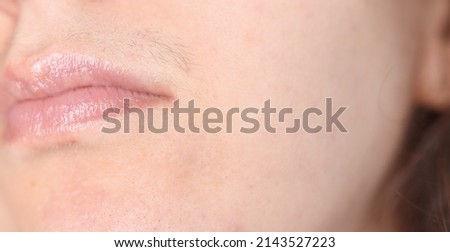 Close-up of a woman's face with hair above the upper lip. Impaired metabolism, increased testosterone in a girl.