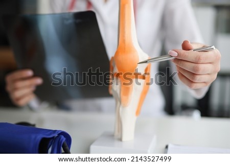 Doctor traumatologist examines x-ray and legs and the model of knee joint Royalty-Free Stock Photo #2143527499
