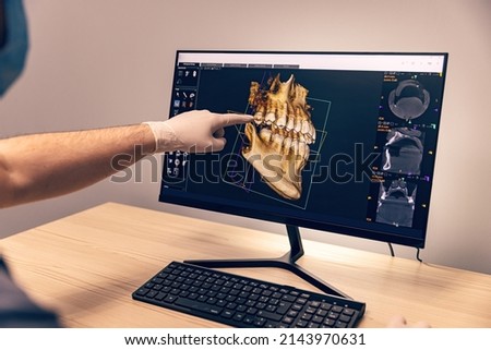 Hands of doctor dentist in gloves show the teeth on x-ray on digital screen in dental clinic