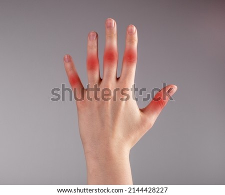 Finger joint pain. Woman hand with red spot closeup. Causes of injuries, sprain, strain. Carpal tunnel syndrome, arthritis, chronic diseases. Health care and medicine concept. High quality photo