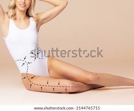 Fat lose, liposuction, sport, fitness, healthy eating, nutrition, fit shape and cellulite removal. Woman with arrows on her body. Royalty-Free Stock Photo #2144765715