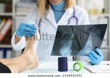 Patient with leg injury at doctor appointment. X-ray with leg injury concept