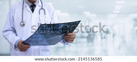 Orthopedics surgeon doctor examining patient's knee joint x-ray films, MRI bone, CT scan in at radiology unit, hospital background. knee joint film x ray, healthcare and medicine concept, close up Royalty-Free Stock Photo #2145136585