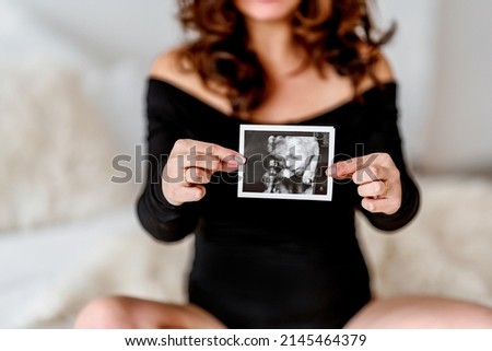 A pregnant woman holds an ultrasound picture with her baby