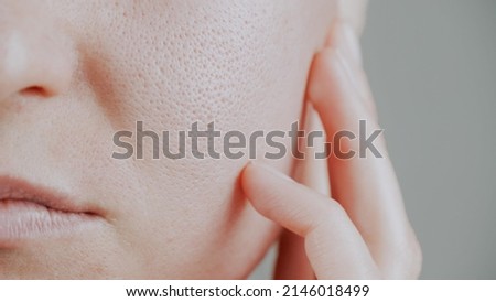 skin with enlarged pores. Part of the face with problem skin Royalty-Free Stock Photo #2146018499