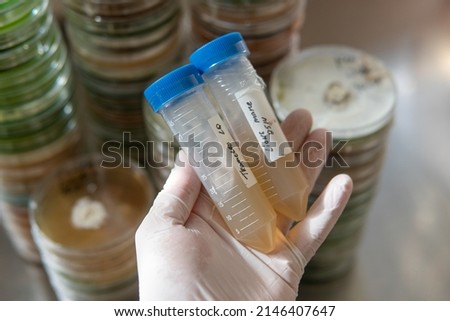 slants with agar for research. Mycology and cultivation of fungi. Royalty-Free Stock Photo #2146407647