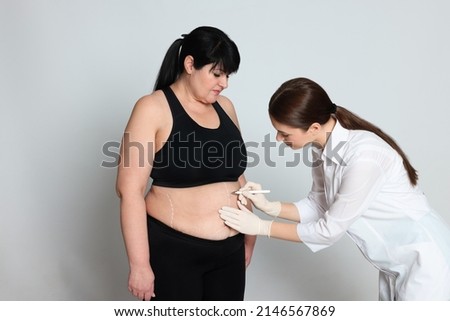 Doctor drawing marks on obese woman's body against light background. Weight loss surgery Royalty-Free Stock Photo #2146567869