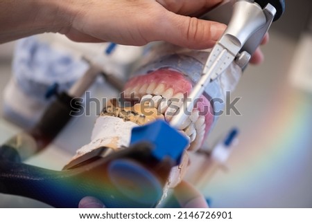 Dental prosthesis, dentures, prosthetics work. A study and a table with dental tools