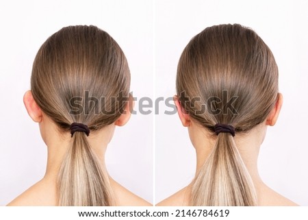 Rear view of a woman's head with ears before and after otoplasty isolated on a white background. Result of cosmetic plastic surgery to correct the auricles and get rid of lop - eared. Beauty concept Royalty-Free Stock Photo #2146784619