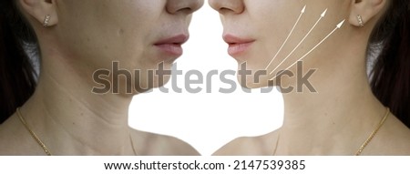 woman double chin before and after treatment Royalty-Free Stock Photo #2147539385