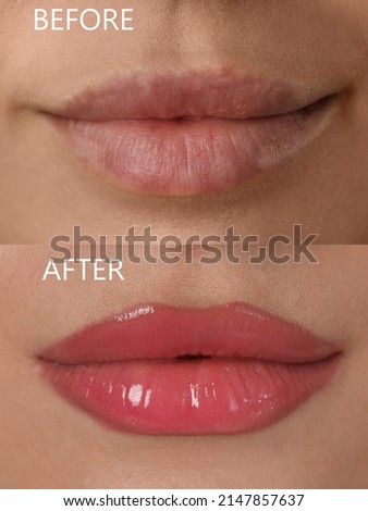 Collage with photos of young woman before and after permanent lip makeup, closeup