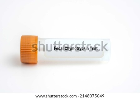Fecal Chymotrypsin Test check up test tube with biological sample