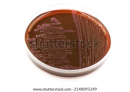 Salmonella Typhimurium bacteria growing on a selective medium in the laboratory of microbiology	 Royalty-Free Stock Photo #2148095249