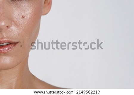 close-up girl with sweaty skin on her face and excessive oily sheen, excessive sweating, hyperhidrosis disease Royalty-Free Stock Photo #2149502219