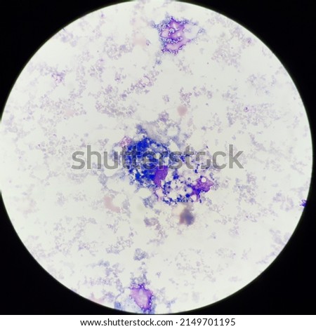 Macrophage cells  in body fluid. Royalty-Free Stock Photo #2149701195