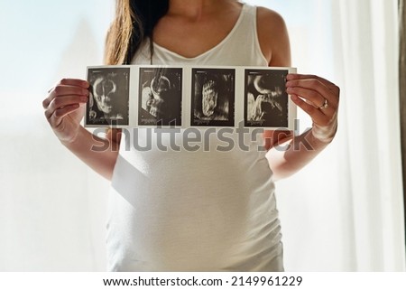 Babys first portrait. Shot of an unidentifiable pregnant woman holding up a series of ultrasound pictures in front of a window at home.