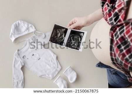 A pregnant girl holds an ultrasound photo of a baby in her hands top view.