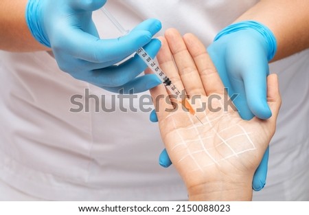 The cosmetologist makes injections of botulinum toxin on the palms of a woman against hyperhidrosis. Women's cosmetology, skin care. Royalty-Free Stock Photo #2150088023
