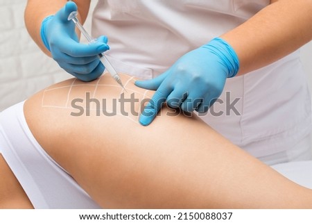A doctor of aesthetic cosmetology makes lipolytic injections to burn body fat on a woman’s on the hips, legs and thighs . Female aesthetic cosmetology in a beauty salon. Royalty-Free Stock Photo #2150088037